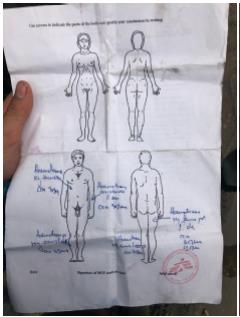 Izkaz Zdravnikov brez meja (MSF) o poškodbah